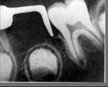distal2.jpg