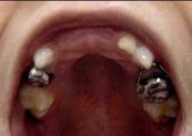 crown-and-loop-1.jpg