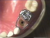 crown-and-loop-2.jpg