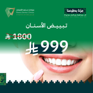 باقة تبييض وتنظيف وكشف بـ999 ريال 🇸🇦