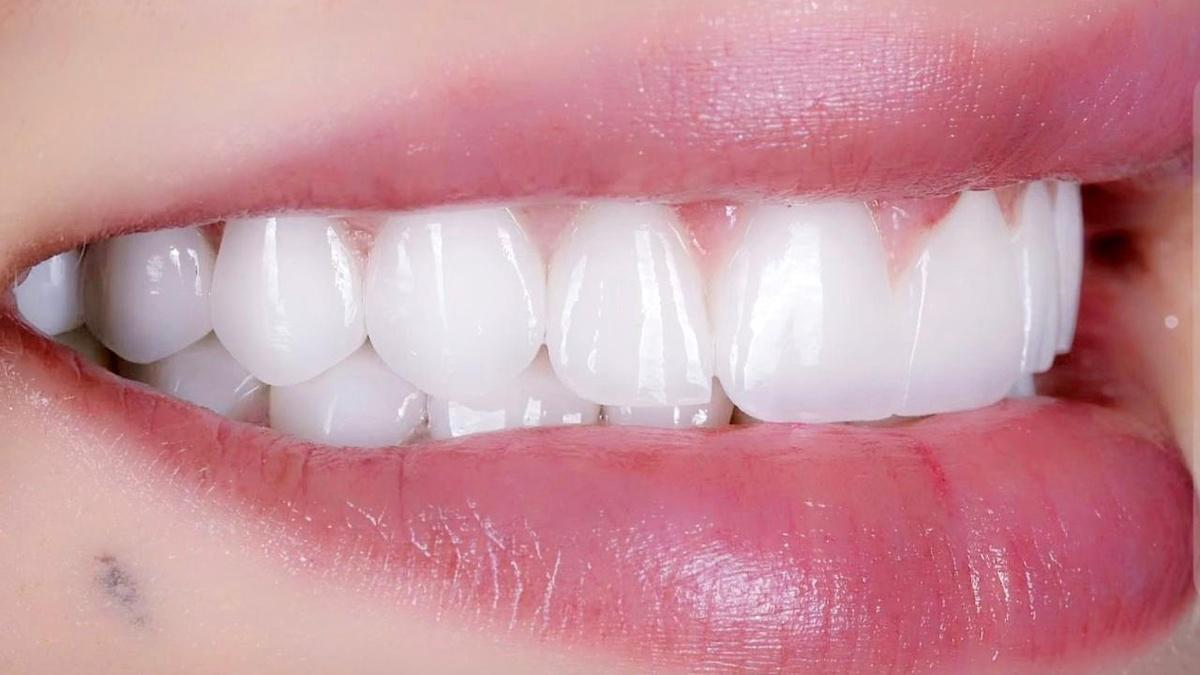 تركيبة ايماكس (E-Max)الطبيعية/ميزة الدفع المسبق الحصري