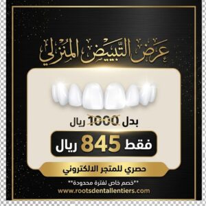 عرض تبييض الأسنان المنزلي بسعر 845 ريال بدلاً من 1000 ريال - عيادات جذور الأسنان في جدة